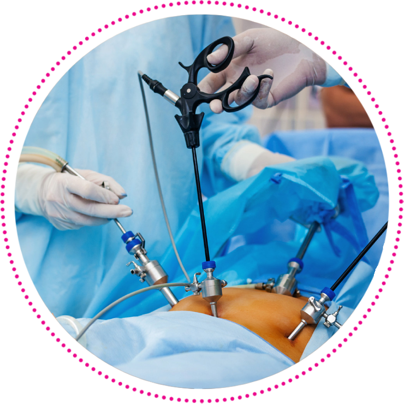 Laparoscopy treatment in baner
