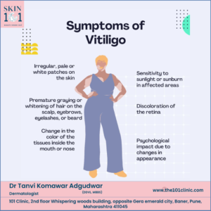 Vitiligo Treatment in baner