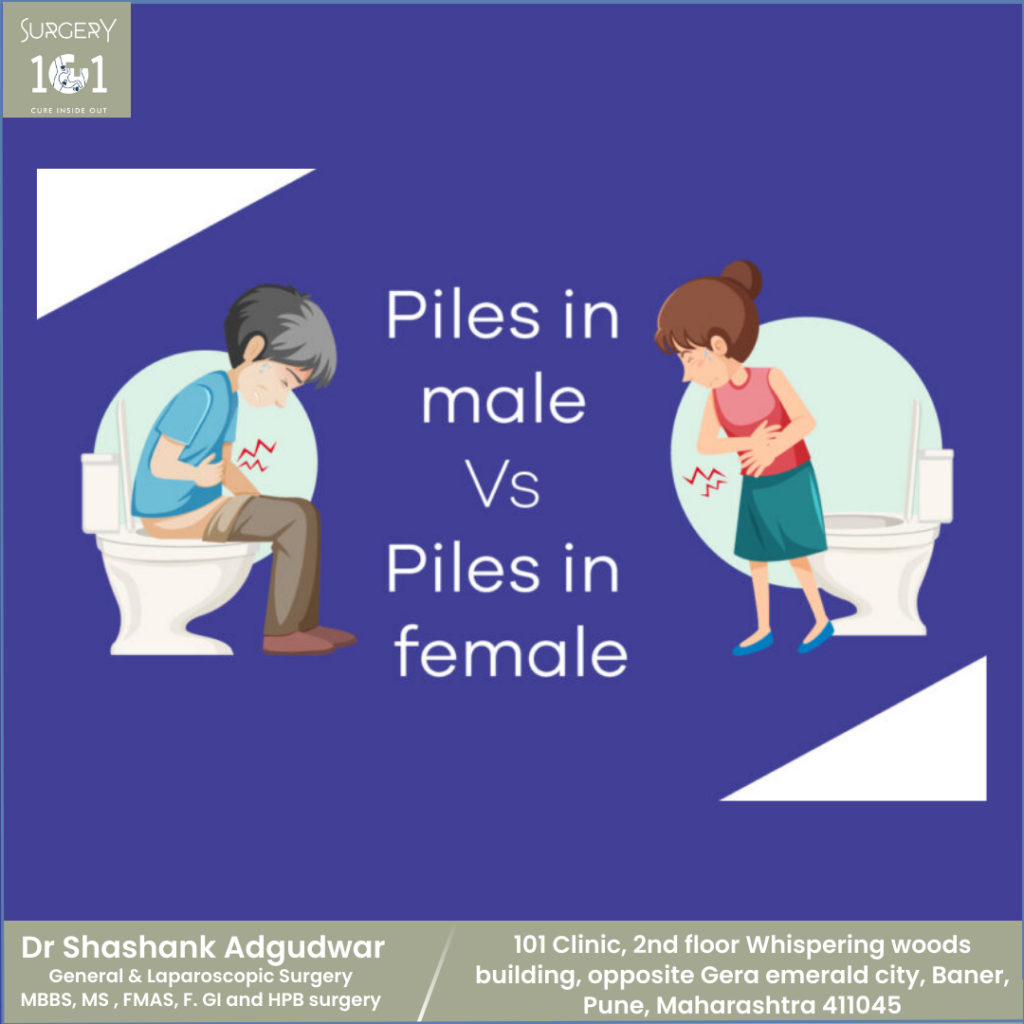 Piles in Male versus