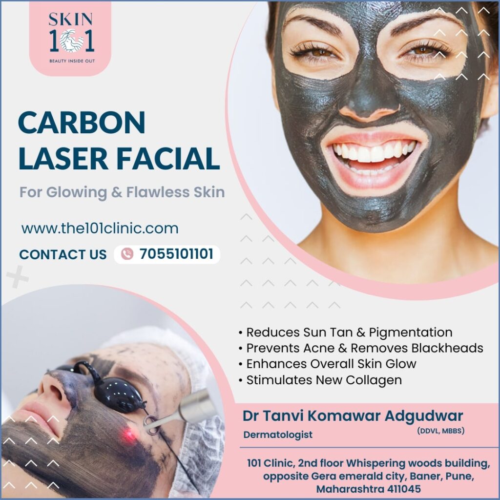 Carbon Laser Facial