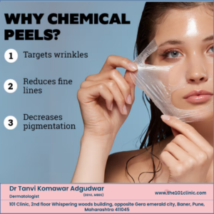 Chemical Peels Treatmenet at Home
