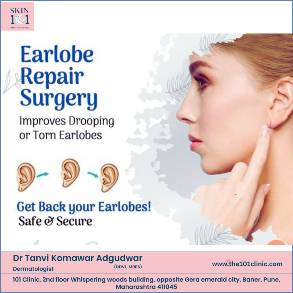 Earlobe Repair Surgery in pune