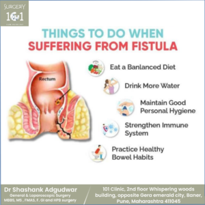 Fistula Treatment in baner