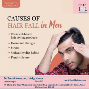 Hair Fall in Men