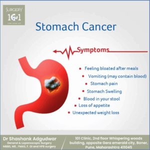 Stomach Cancer Treatment