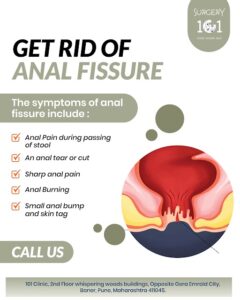 Anal Fissure Treatment in Baner