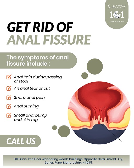 Anal Fissure Treatment in Baner