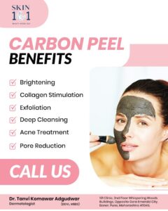 Carbon Peel Treatment in baner