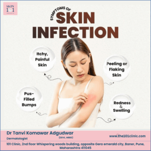 Skin Infections