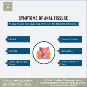 Anal Fissure Treatment in Pune, Baner