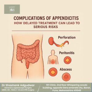 Appendix Treatment