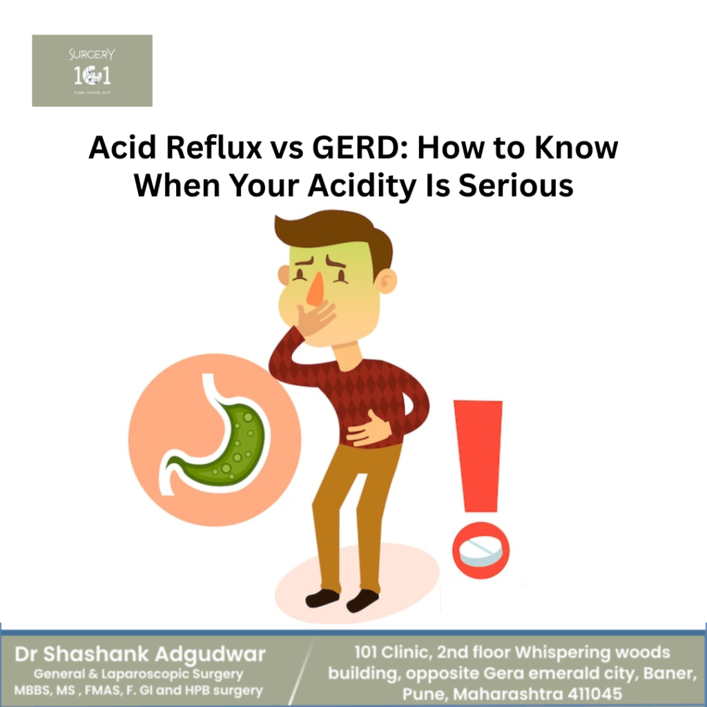 Acid Reflux vs GERD