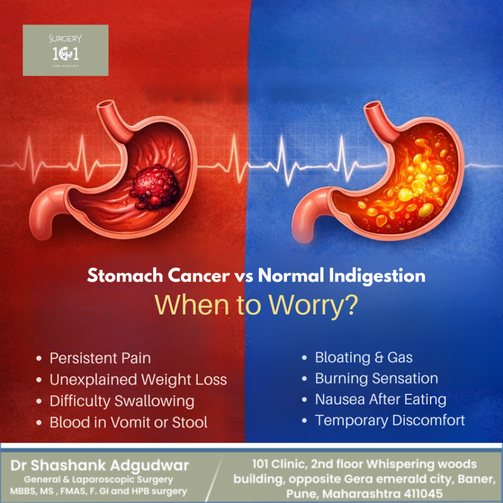 Stomach Cancer vs Normal Indigestion