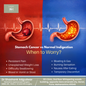 Stomach Cancer vs Normal Indigestion