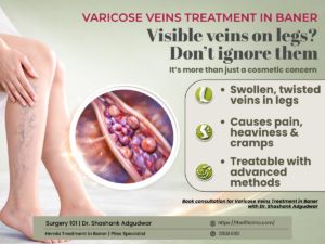 Varicose Veins treatment in baner