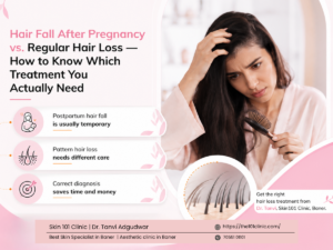 hair loss treatment in Baner