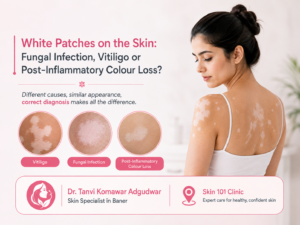 Skin Specialist in Baner